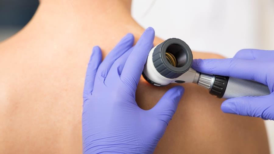 La télé-expertise en dermatologie remboursée