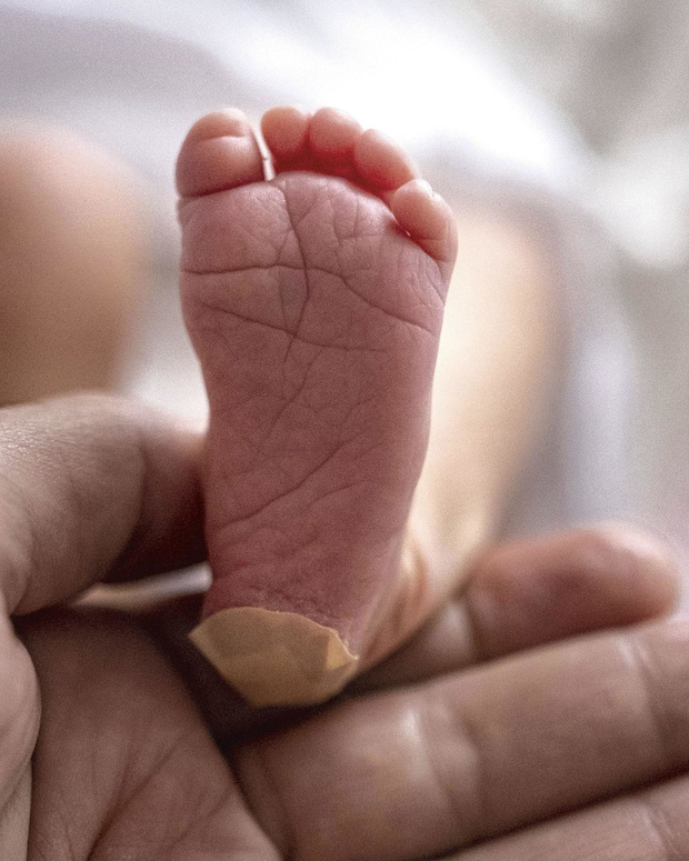 Les défis du dépistage néonatal génomique 